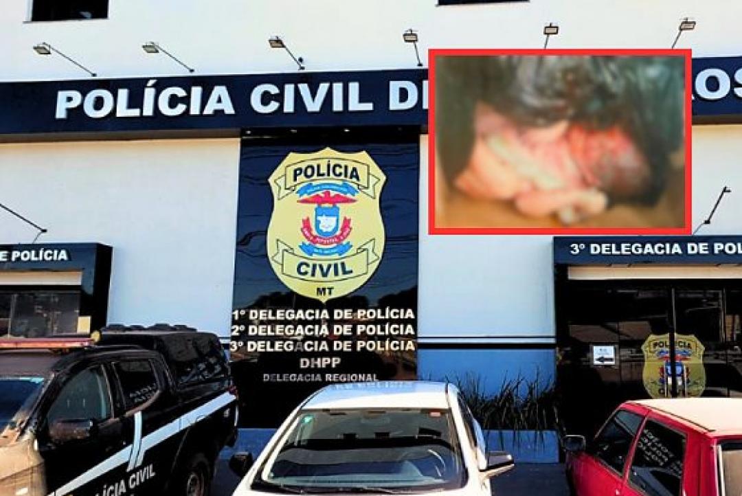 Polícia faz DNA e analisa câmeras de condomínio para achar responsável por bebê jogado no lixo