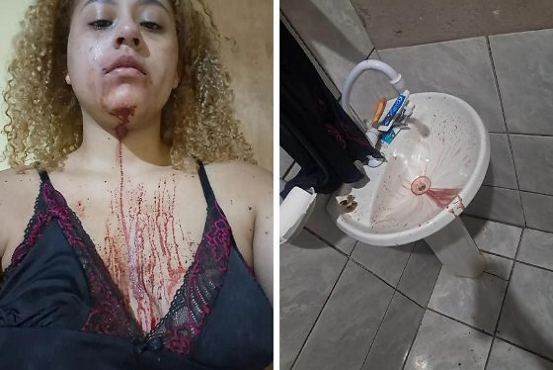 Estudante de Direito diz ter sido agredida por PMs dentro de casa na frente do filho e da avó acamada