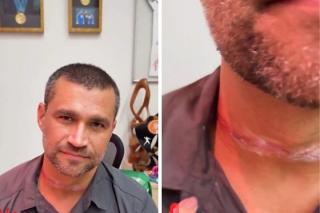 Secretário de Esportes de Cuiabá quase é degolado por fio de telefone