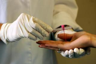 SES reforça ações para enfrentar a hanseníase em Mato Grosso