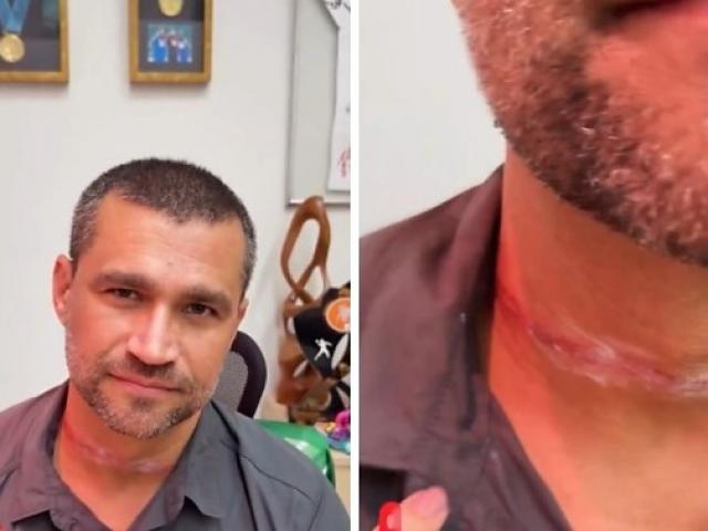Secretário de Esportes de Cuiabá quase é degolado por fio de telefone
