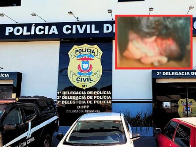 Polícia faz DNA e analisa câmeras de condomínio para achar responsável por bebê jogado no lixo