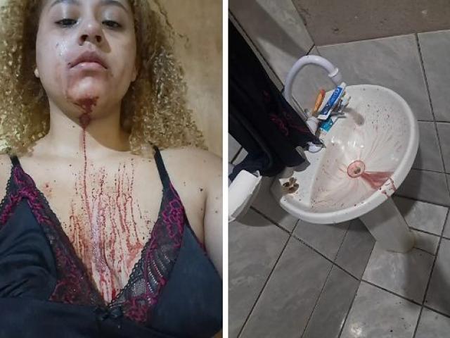 Estudante de Direito diz ter sido agredida por PMs dentro de casa na frente do filho e da avó acamada
