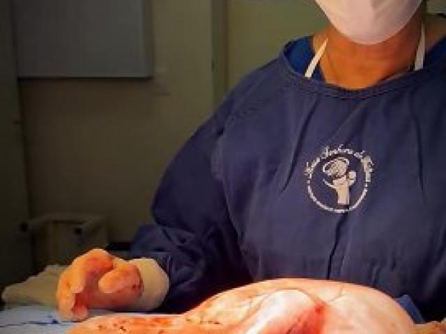 Bebê nasce dentro da bolsa amniótica em hospital de Sorriso; vídeo