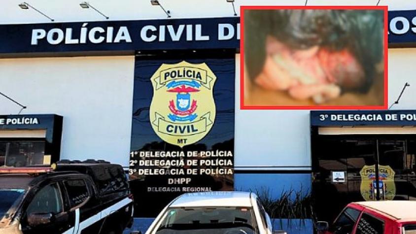 Polícia faz DNA e analisa câmeras de condomínio para achar responsável por bebê jogado no lixo