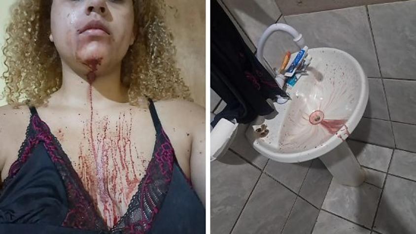 Estudante de Direito diz ter sido agredida por PMs dentro de casa na frente do filho e da avó acamada